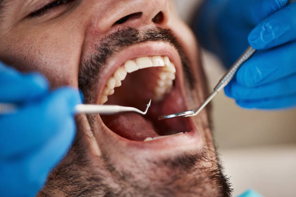 Best Emergency Dentist for Knocked-Out Tooth in Odenville, AL